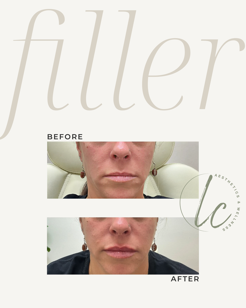 The Cheek-to-Chic Bundle